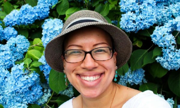 A trajetória de pacientes com alopecia areata na busca por autoestima e bem-estar