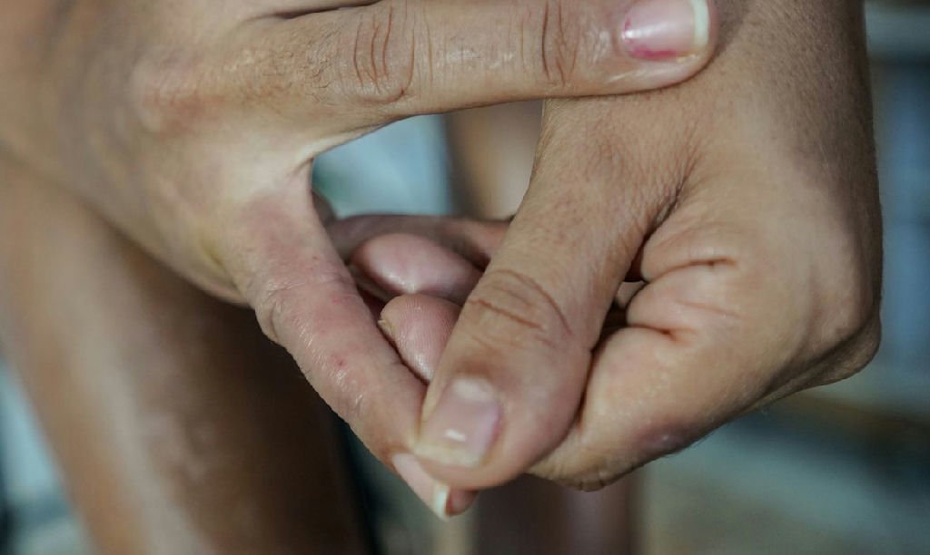 Dermatite atópica: o impacto invisível na saúde mental e na rotina dos pacientes